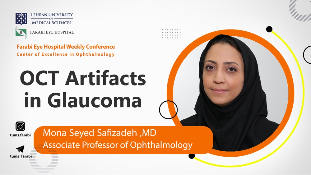 OCT Artifacts در گلوکوم